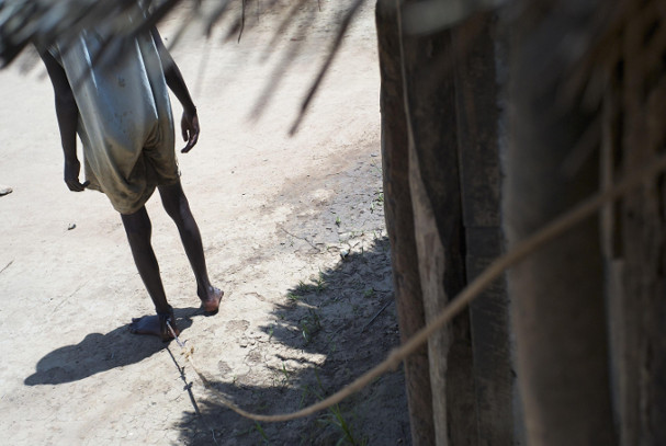 US-Uganda partnership uncovers potential culprit in mysterious nodding syndrome
