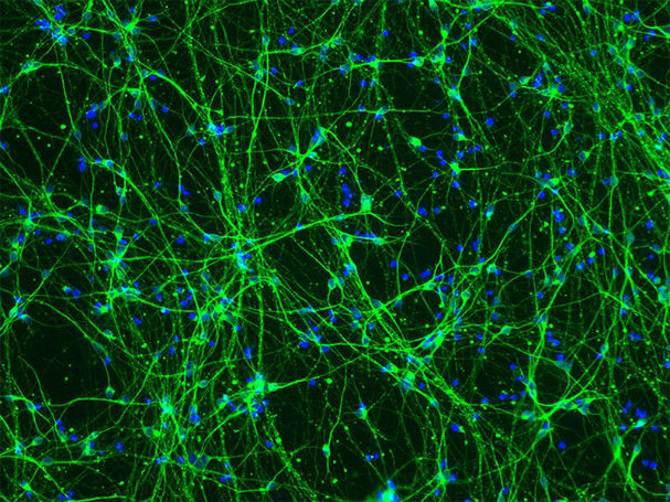 Stem-cell and genetic therapies make a healthy marriage
