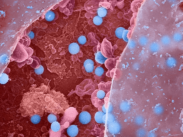 The high burden of infectious disease