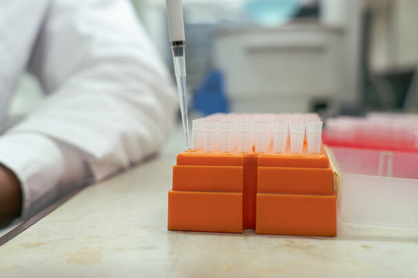 Slow, difficult and expensive: How the lab supplies market is crippling African science