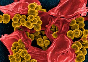 Antibiotic – antibody combination puts drug-resistant staph in its crosshairs