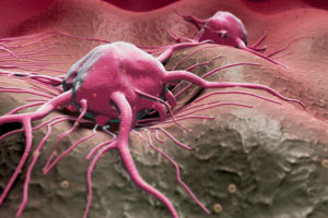 New tumour growth mechanism identified
