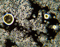 How yeast cells begin self-destruction
