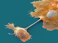 Tracking and targeting therapy resistance in pancreatic cancer