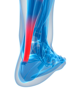 Revealing the hidden strength of Achilles-heel connection