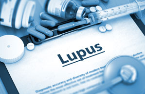 Drug lead for lupus