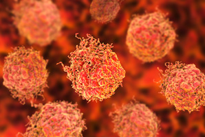 A bone to pick with prostate cancer