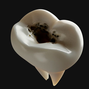 Probing tooth decay using pH