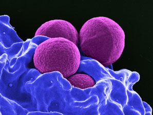 The metal uptake mechanism that keeps bacteria harmful