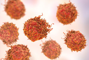 MicroRNAs leave cancer quaking