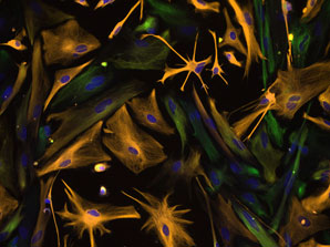 The paradox of neuroimmune activation in ALS