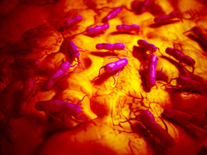Tackling tumours with lasers and salmonella
