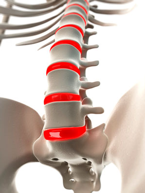 Gel injections could soothe lower back pain