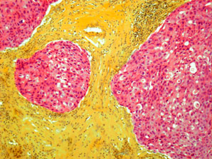 How tumours keep their metabolic state