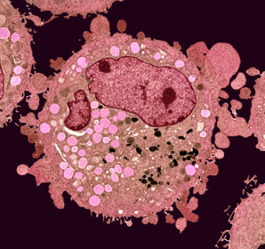 Getting heavy with electron microscopy