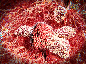 ‘Exhausted’ cells may be invigorated against cancer