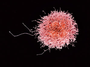 Boosting cancer therapies with natural killer cells