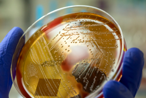 Toxin from group B streptococcus decoded