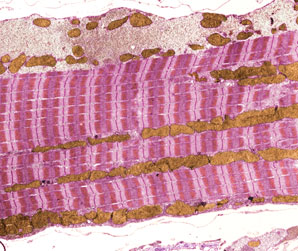 Regulatory RNA linked to muscle formation