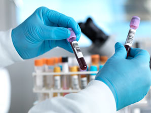 A new test for Huntington’s progression