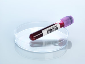 Magnetic nanoparticles can catch cancers early