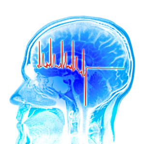 Monitoring brain waves of the slow variety