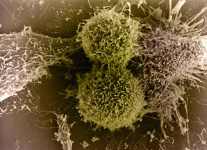 Tired T cells? Blame TOX