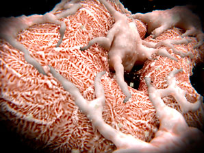 Gut metabolite linked to diabetic kidney disease