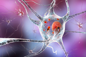 A peek inside Parkinson’s brain clumps