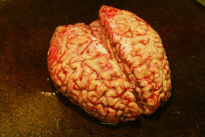 Brain mutations linked to Alzheimer’s disease