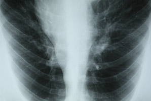 An alarm clock for airway stem cells