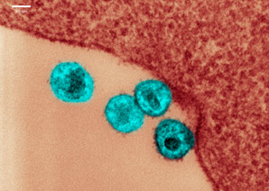 HIV treatment could induce viral reservoir
