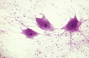 Handling stem cells with care