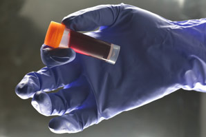 Chemokine levels predict cancer immunotherapy success