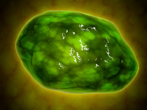 Nanoparticles exploit weakness in cancer cells’ waste-management system