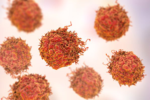 Protein loss is cancer’s gain