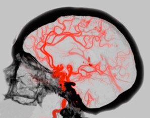 AI offers window into brain vasculature