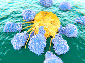 Cancer-secreted protein shuts down anti-tumour immunity