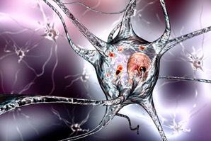 Factors affecting protein folding in neurodegenerative diseases