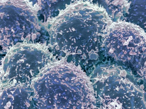 How some lung cancer cells develop drug resistance