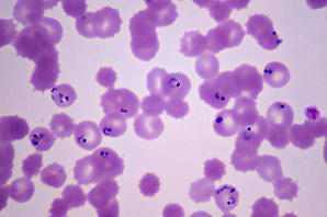 A new target for malaria drug development