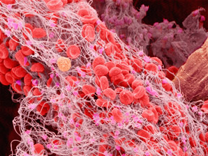 Cancer vaccine inspired by blood clots