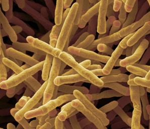 Tuberculosis drug targets take shape