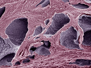 Cancer cells are stronger together