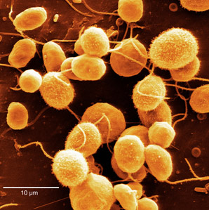 Light-sensing structure steers algae to safety