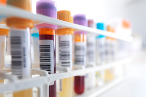 Tracking cancer treatment from the get go
