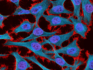 Nanodiamonds used to measure heat flow inside cells