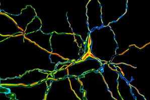 New dopamine-neuron firing pattern found