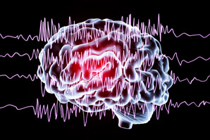 Implantable drug-delivery device could save lives in epilepsy