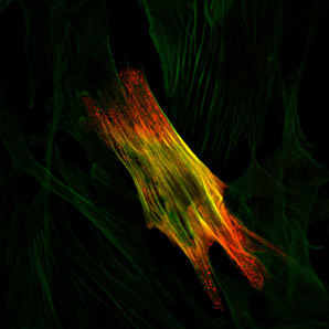 Polymer dots show promise in expansion microscopy